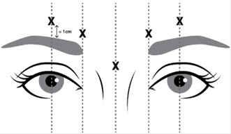 Pill image for These Highlights Do Not Include All The Information Needed To Use Jeuveau®