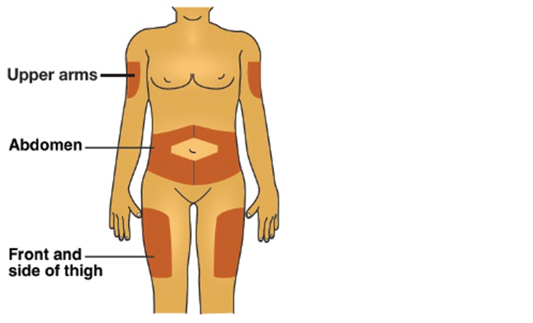 Pill image for These Highlights Do Not Include All The Information Needed To Use Insulin Glargine-yfgn Safely And Effectively. See Full Prescribing Information For Insulin Glargine-yfgn.