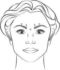 Pill image for These Highlights Do Not Include All The Information Needed To Use Botox Cosmetic Safely And Effectively. See Full Prescribing Information For Botox Cosmetic.