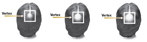 Pill image for Cvs Pharmacy, Inc. Hair Regrowth Treatment Drug Facts