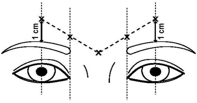 Pill image for These Highlights Do Not Include All The Information Needed To Use Dysport Safely And Effectively. See Full Prescribing Information For Dysport.