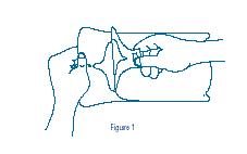 Pill image for 0.9% Sodium Chloride Irrigation, Usp