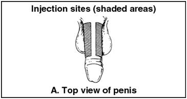Pill image for These Highlights Do Not Include All The Information Needed To Use Caverject Safely And Effectively. See Full Prescribing Information For Caverject.