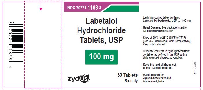 Pill image for Labetalol Hydrochloride Tablets, Usp
