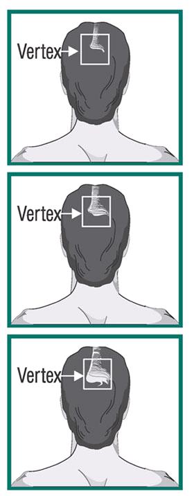 Pill image for Minoxidil Topical Solution 2% (for Men)