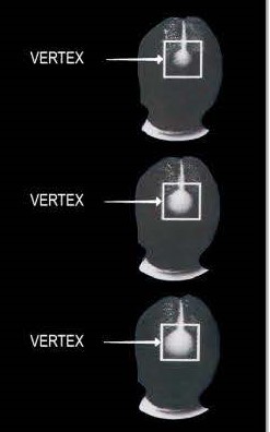 Pill image for ​81653-003 Update