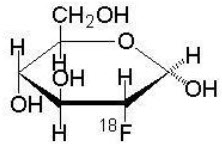 Pill image for These Highlights Do Not Include All The Information Needed To Use Fludeoxyglucose F 18 Injection Safely And Effectively. See Full Prescribing Information For Fludeoxyglucose F 18 Injection.