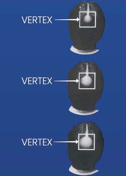 Pill image for ​81653-005 Update